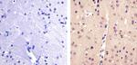 PAX3 Antibody in Immunohistochemistry (Paraffin) (IHC (P))