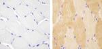 VPS34 Antibody in Immunohistochemistry (Paraffin) (IHC (P))