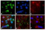 PSME1 Antibody