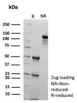 KNG1/Kininogen 1 (KNG1-Heavy chain) Antibody in SDS-PAGE (SDS-PAGE)