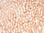 KNG1/Kininogen 1 (KNG1-Heavy chain) Monoclonal Antibody (KNG1/7423)