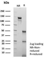 Arginase 1 (Hepatocellular Carcinoma Marker) Antibody in SDS-PAGE (SDS-PAGE)