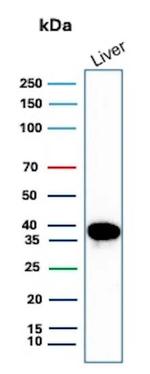 Arginase 1 (Hepatocellular Carcinoma Marker) Antibody in Western Blot (WB)