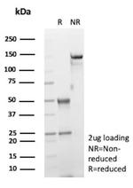 Arginase 1 (Hepatocellular Carcinoma Marker) Antibody in SDS-PAGE (SDS-PAGE)