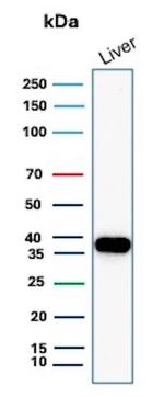 Arginase 1 (Hepatocellular Carcinoma Marker) Antibody in Western Blot (WB)