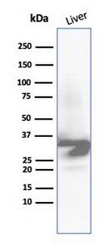 Arginase 1 (Hepatocellular Carcinoma Marker) Antibody in Western Blot (WB)