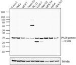 PSME3 Polyclonal Antibody