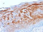 Cytokeratin 1 (Suprabasal Keratinocyte Marker) Monoclonal Antibody (LHK1)