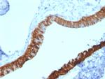 Cytokeratin 3 (KRT3) (Corneal Epithelial Marker) Monoclonal Antibody (KRT3/2130)