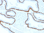 Cytokeratin 5 (KRT5) (Basal, Myoepithelial & Mesothelial Cell Marker) Antibody in Immunohistochemistry (Paraffin) (IHC (P))