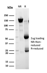 Cytokeratin 5 (KRT5) (Basal, Myoepithelial & Mesothelial Cell Marker) Antibody in SDS-PAGE (SDS-PAGE)
