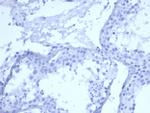 Cytokeratin 5 (KRT5) Recombinant Mouse Monoclonal Antibody (rKRT5, 6398)