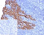Cytokeratin 5 (KRT5) (Basal, Myoepithelial and Mesothelial Cell Marker) Antibody in Immunohistochemistry (Paraffin) (IHC (P))