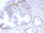Cytokeratin 5 (KRT5) (Basal, Myoepithelial and Mesothelial Cell Marker) Antibody in Immunohistochemistry (Paraffin) (IHC (P))