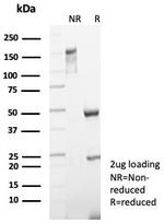 Cytokeratin 5 (KRT5) (Basal, Myoepithelial and Mesothelial Cell Marker) Antibody in SDS-PAGE (SDS-PAGE)