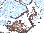 Cytokeratin 5 (KRT5) (Basal, Myoepithelial and Mesothelial Cell Marker) Antibody in Immunohistochemistry (Paraffin) (IHC (P))