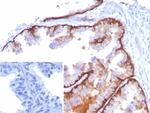 Cytokeratin 5 (KRT5) (Basal, Myoepithelial and Mesothelial Cell Marker) Antibody in Immunohistochemistry (Paraffin) (IHC (P))