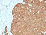 Cytokeratin 5 (KRT5) Recombinant Rabbit Monoclonal Antibody (KRT5, 4245R)