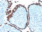 Cytokeratin 5 (KRT5) Antibody in Immunohistochemistry (Paraffin) (IHC (P))