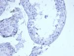 Cytokeratin 5 (KRT5) Recombinant Rabbit Monoclonal Antibody (KRT5, 6399R)