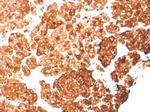 Cytokeratin 6A (KRT6A) (Basal Cell Marker) Monoclonal Antibody (rKRT6A/2100)