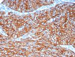 Cytokeratin 6A (KRT6A) (Basal Cell Marker) Antibody in Immunohistochemistry (Paraffin) (IHC (P))