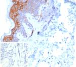 Cytokeratin 6/KRT6 (Pan; a,b,c) (Basal Cell Marker) Recombinant Rabbit Monoclonal Antibody (KRT6/8267R)