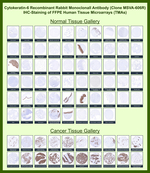 Cytokeratin 6A (KRT6A) (Basal Cell Marker) Recombinant Rabbit Monoclonal Antibody (MSVA-606R)