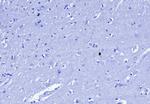 Cytokeratin 6A (KRT6A) (Basal Cell Marker) Antibody in Immunohistochemistry (Paraffin) (IHC (P))