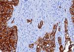 Cytokeratin 6A (KRT6A) (Basal Cell Marker) Antibody in Immunohistochemistry (Paraffin) (IHC (P))