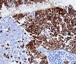 Cytokeratin 6A (KRT6A) (Basal Cell Marker) Antibody in Immunohistochemistry (Paraffin) (IHC (P))