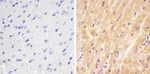 SMAD1 Polyclonal Antibody