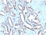 Cytokeratin 7 (Glandular and Transitional Epithelial Marker) Antibody in Immunohistochemistry (Paraffin) (IHC (P))