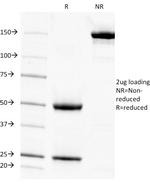 Cytokeratin 7 (Glandular and Transitional Epithelial Marker) Antibody in SDS-PAGE (SDS-PAGE)