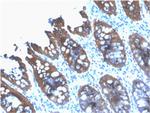 Cytokeratin 8 (KRT8) Antibody in Immunohistochemistry (Paraffin) (IHC (P))