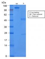 Cytokeratin 8 (KRT8) Antibody in SDS-PAGE (SDS-PAGE)