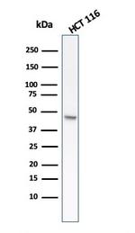 Cytokeratin 8 (KRT8) Antibody in Western Blot (WB)