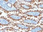 Cytokeratin 8 (KRT8) Antibody in Immunohistochemistry (Paraffin) (IHC (P))
