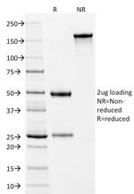 Cytokeratin 10 (KRT10) (Suprabasal Epithelial Marker) Antibody in SDS-PAGE (SDS-PAGE)