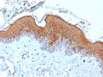 Cytokeratin 10 (Suprabasal Epithelial Marker) Antibody in Immunohistochemistry (Paraffin) (IHC (P))