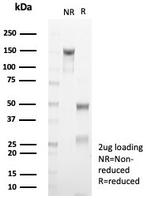 Cytokeratin 10 (Suprabasal Epithelial Marker) Antibody in SDS-PAGE (SDS-PAGE)