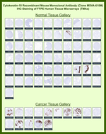 Cytokeratin 10 (Suprabasal Epithelial Marker) Recombinant Mouse Monoclonal Antibody (MSVA-610M)