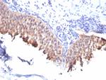 Cytokeratin 10 (Suprabasal Epithelial Marker) Antibody in Immunohistochemistry (Paraffin) (IHC (P))