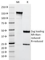 Cytokeratin 10 (Suprabasal Epithelial Marker) Antibody in SDS-PAGE (SDS-PAGE)