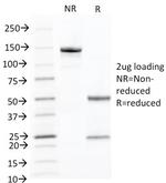 Cytokeratin 10 (Suprabasal Epithelial Marker) Antibody in SDS-PAGE (SDS-PAGE)