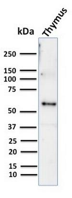 Cytokeratin 10 (Suprabasal Epithelial Marker) Antibody in Western Blot (WB)