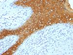 Cytokeratin 10 (Suprabasal Epithelial Marker) Antibody in Immunohistochemistry (Paraffin) (IHC (P))