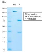 Cytokeratin 10 (KRT10) (Suprabasal Epithelial Marker) Antibody in SDS-PAGE (SDS-PAGE)