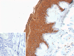 Cytokeratin 10 (KRT10) (Suprabasal Epithelial Marker) Recombinant Rabbit Monoclonal Antibody (KRT10/9605R)