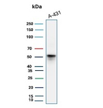 Cytokeratin 10 (KRT10) (Suprabasal Epithelial Marker) Antibody in Western Blot (WB)
